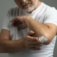 Hombre con barba aplica vaselina en su codo. La vaselina sirve para hidratar y proteger la piel seca.