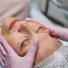 Manos enguantadas realizan tratamiento de radiofrecuencia en la cara de una mujer, buscando rejuvenecer su piel.