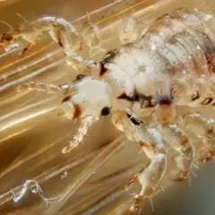 Un piojo de cabeza, con sus patas y garras, aferrado a un cabello. ¿Por qué salen piojos de la nada?