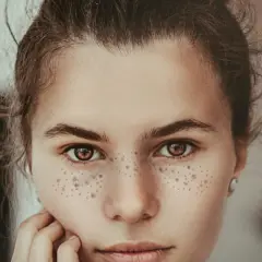 Primer plano de una joven con hermosos lunares en la cara, su mirada es cautivadora.