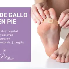 Persona aplica un parche para tratar un ojo de gallo en el pie. El texto indica "Ojo de gallo en pie" y ofrece información sobre causas, síntomas y tratamientos.