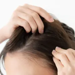 Manos revisando el cuero cabelludo, buscando remedios caseros para fortalecer el pelo fino y mejorar su volumen.