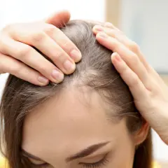 Manos revisando el cuero cabelludo, buscando soluciones sobre como evitar la caida del pelo.