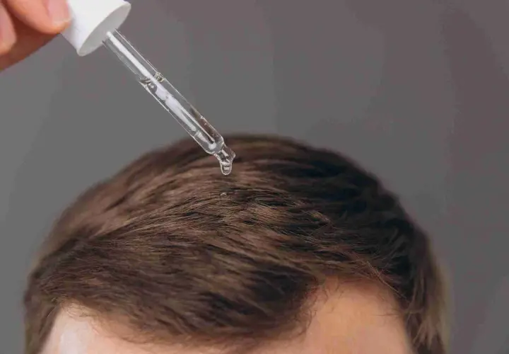 Gotas de suero aplicadas en el cuero cabelludo para saber como hacer crecer el pelo rapido.