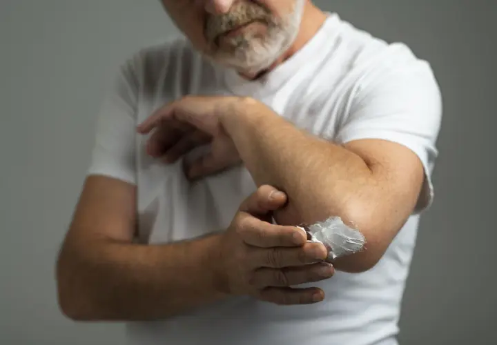 Hombre con barba aplica vaselina en su codo. La vaselina sirve para hidratar y proteger la piel seca.
