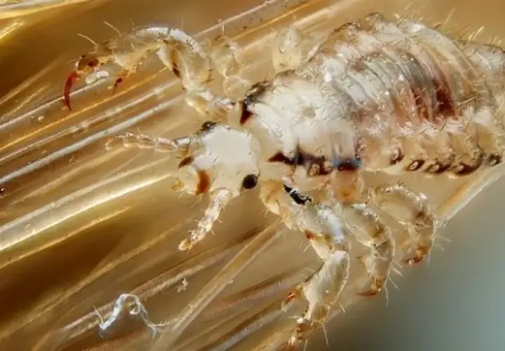 Un piojo de cabeza, con sus patas y garras, aferrado a un cabello. ¿Por qué salen piojos de la nada?