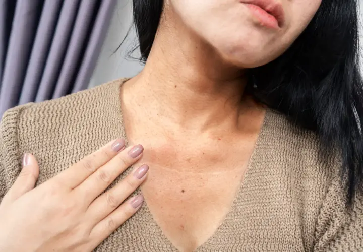 Primer plano del cuello y escote de una mujer con manchas marrones en la piel con relieve, algunas pecas y una pequeña marca.