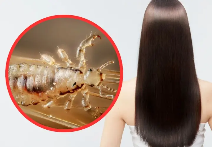 Primer plano de un piojo en un cabello liso y oscuro. Los piojos saltan y se reproducen rápidamente.