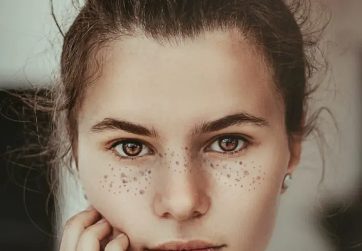 Primer plano de una joven con hermosos lunares en la cara, su mirada es cautivadora.