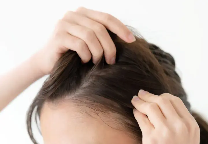 Manos revisando el cuero cabelludo, buscando remedios caseros para fortalecer el pelo fino y mejorar su volumen.
