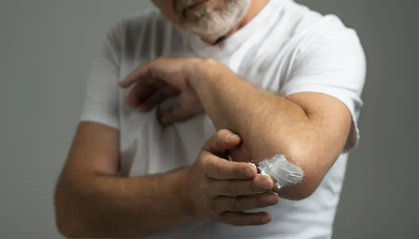 Hombre con barba aplica vaselina en su codo. La vaselina sirve para hidratar y proteger la piel seca.