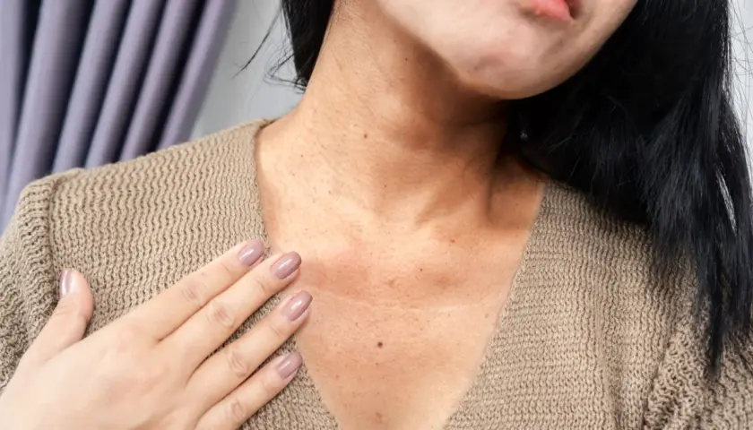 Primer plano del cuello y escote de una mujer con manchas marrones en la piel con relieve, algunas pecas y una pequeña marca.