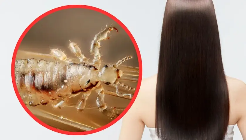Primer plano de un piojo en un cabello liso y oscuro. Los piojos saltan y se reproducen rápidamente.