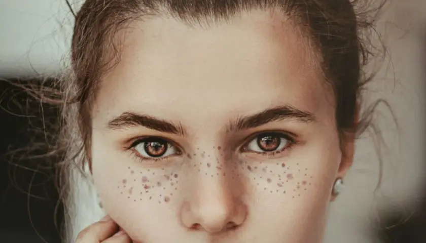 Primer plano de una joven con hermosos lunares en la cara, su mirada es cautivadora.