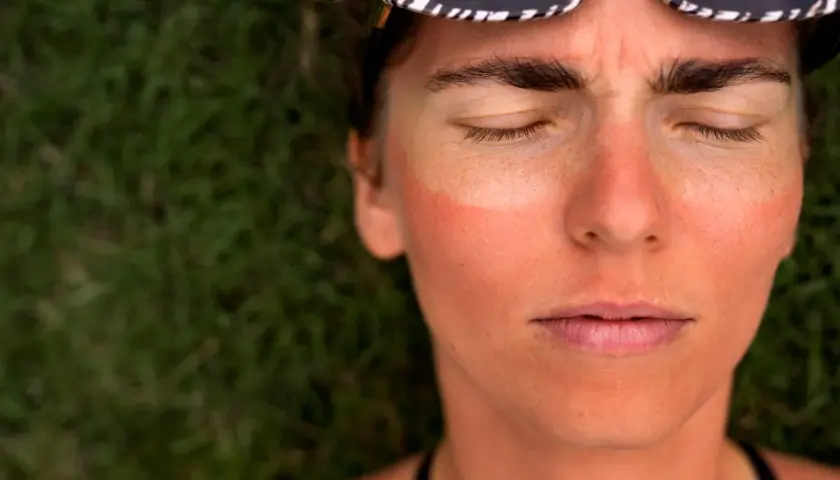 Rostro de mujer con los ojos cerrados, mejillas enrojecidas por el sol y gafas de sol con estampado de cebra. Evidencia de fotoenvejecimiento por el sol.