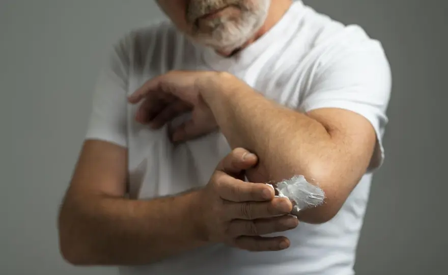 Vaselina para la piel - usos, beneficios y precauciones