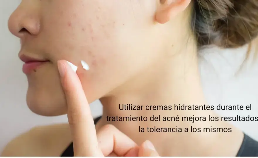 ¿Es bueno echarse crema hidratante en los granos? Cómo elegirla