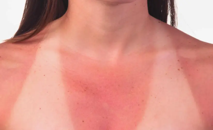 ¿Qué pasa si te echas crema solar caducada?