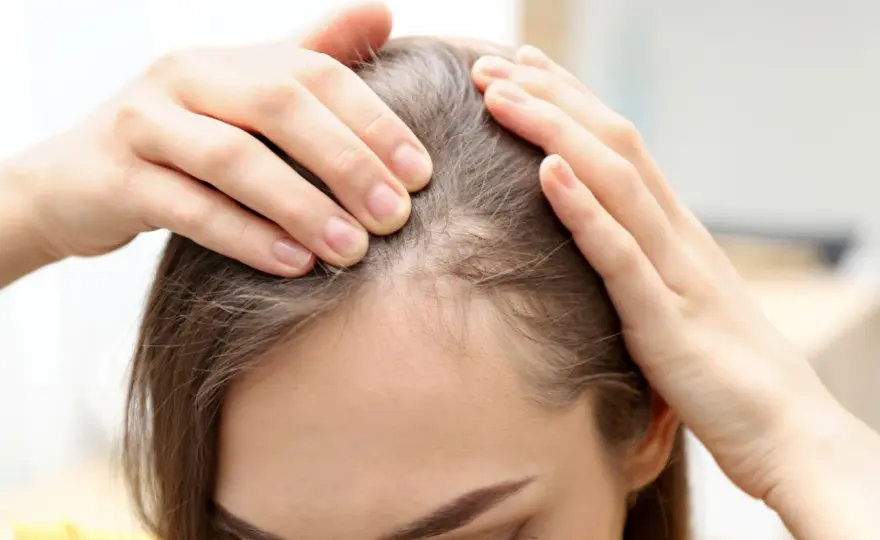 Cómo prevenir la caída del cabello sin caer en falsos remedios