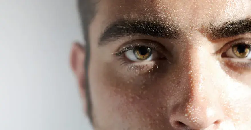 Hiperhidrosis facial - cómo controlar el sudor y cuándo consultar
