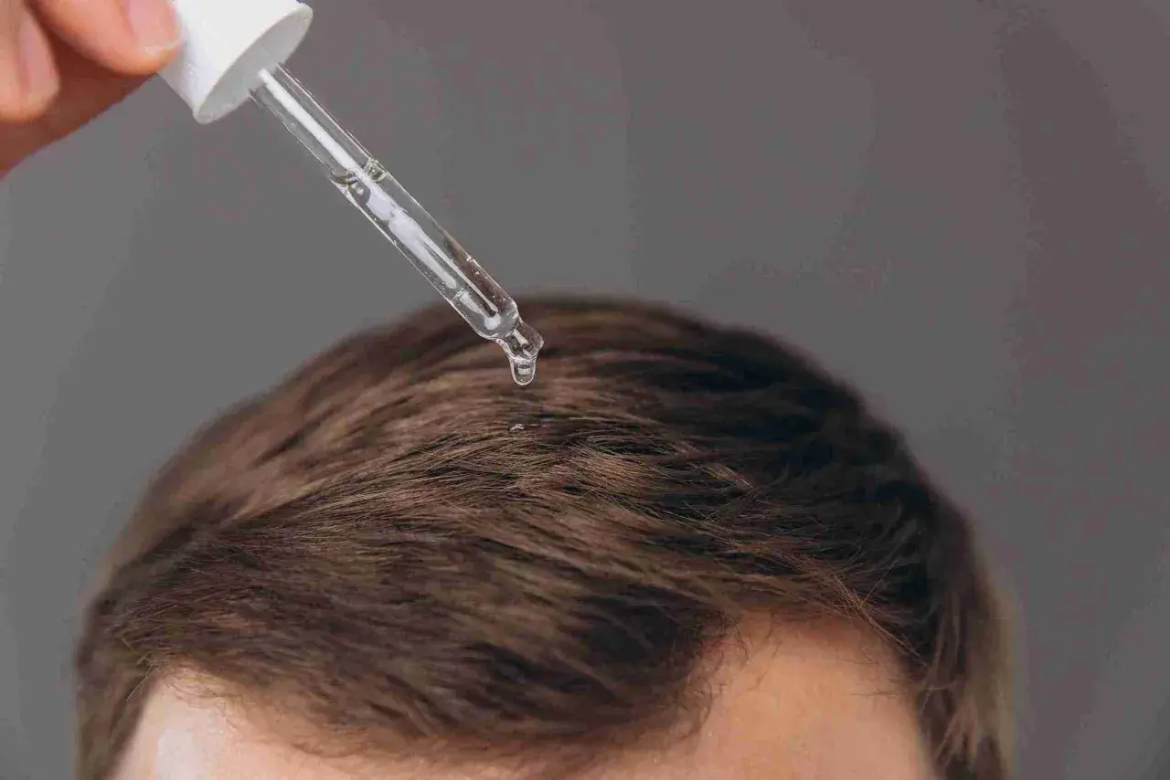 Gotas de suero aplicadas en el cuero cabelludo para saber como hacer crecer el pelo rapido.