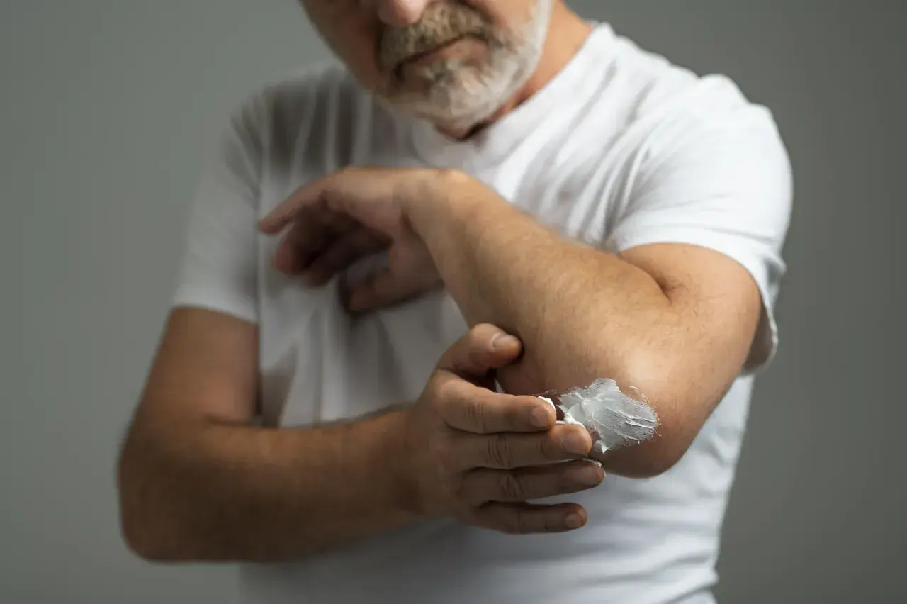 Hombre con barba aplica vaselina en su codo. La vaselina sirve para hidratar y proteger la piel seca.