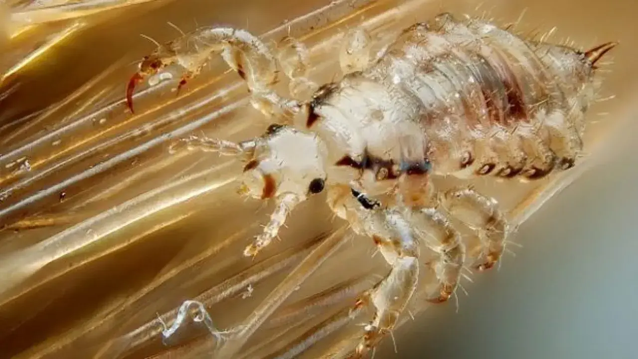 Un piojo de cabeza, con sus patas y garras, aferrado a un cabello. ¿Por qué salen piojos de la nada?