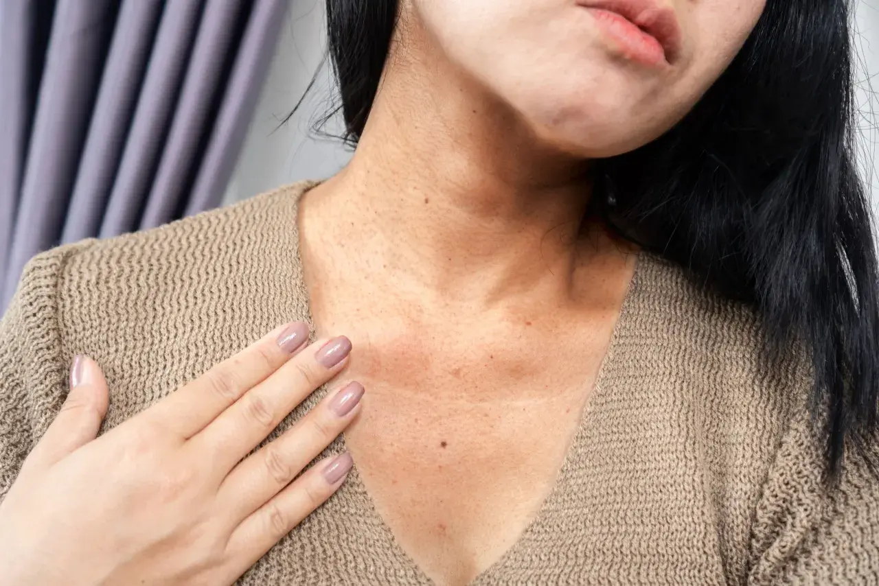 Primer plano del cuello y escote de una mujer con manchas marrones en la piel con relieve, algunas pecas y una pequeña marca.