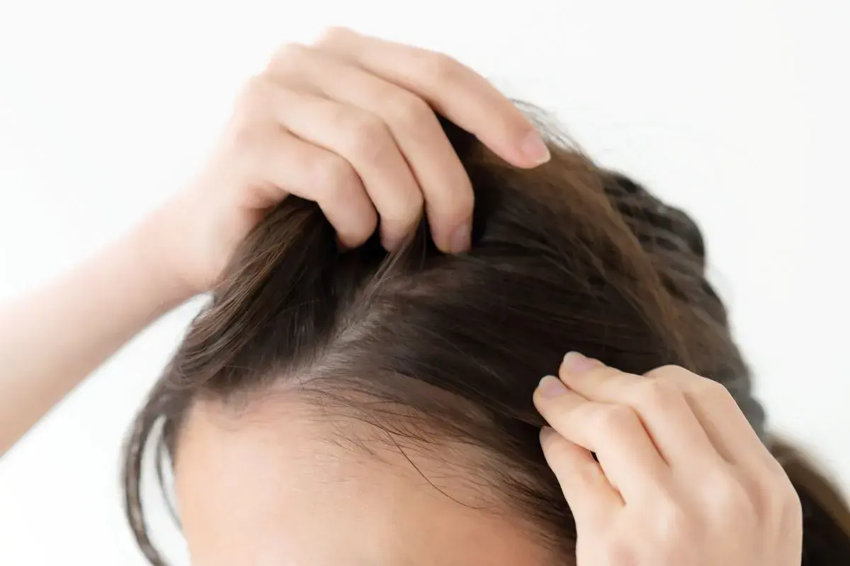 Manos revisando el cuero cabelludo, buscando remedios caseros para fortalecer el pelo fino y mejorar su volumen.
