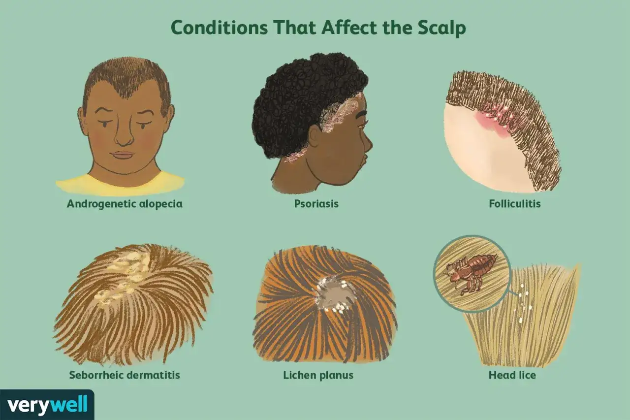 Ilustración de diversas enfermedades del cuero cabelludo: alopecia, psoriasis, foliculitis, dermatitis seborreica, liquen plano y piojos.